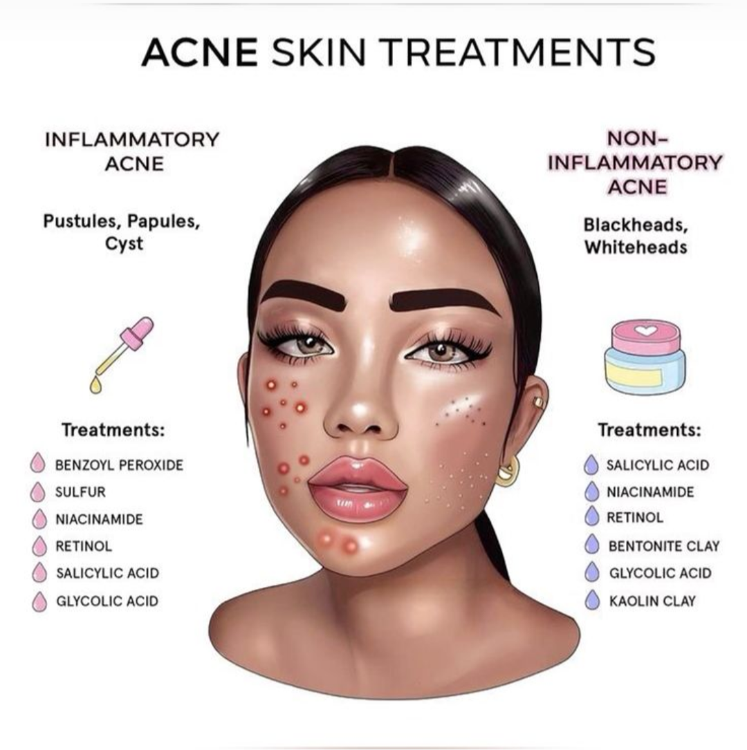 Best Acne Treatment in Nashik | Clear Skin with Expert Ca... main image
