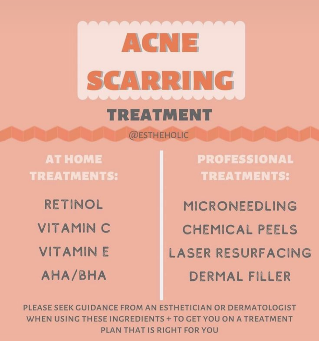 Best acne scar treatment in Nashik main image