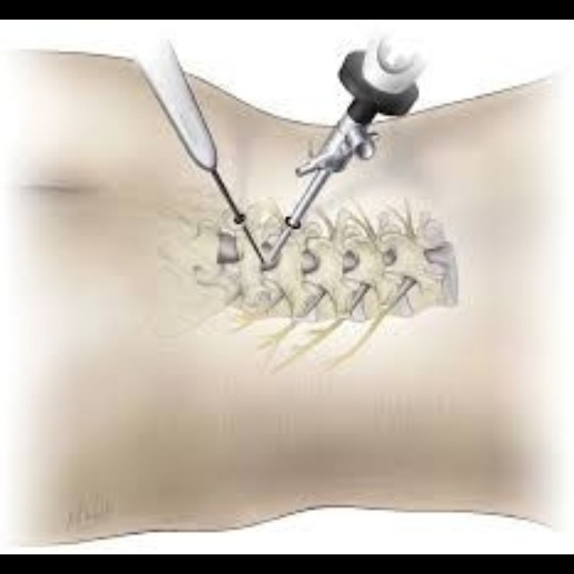 Endoscopic Spine Surgery in Kalyan East for Minimally Invasive Back Treatme... main image