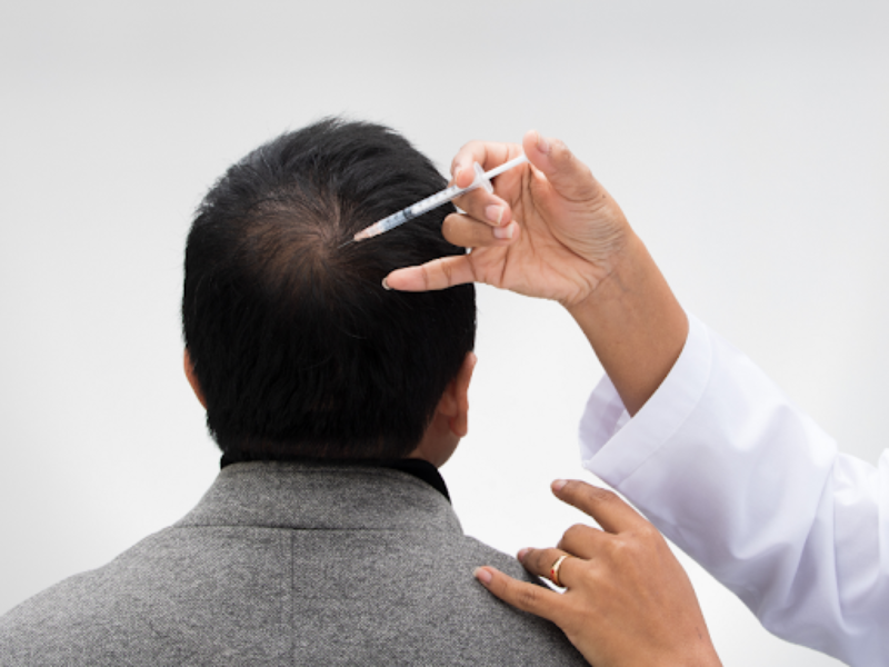 Hair Growth in Chennai main image