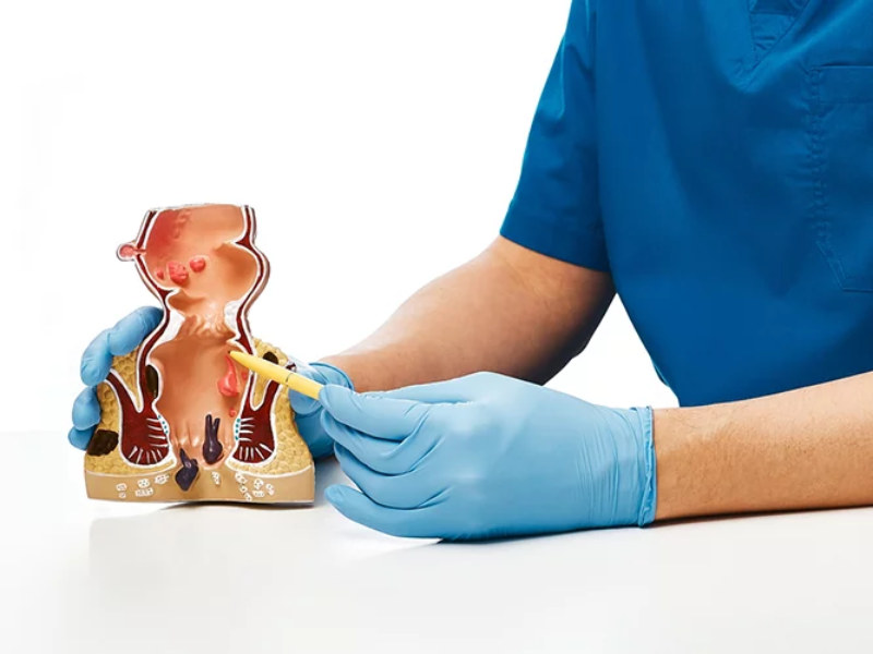 Piles Treatment In Tharamani – Fast Relief With Expert Guida... main image