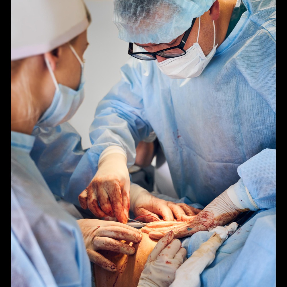 AV Fistula Surgery in Dombivli main image