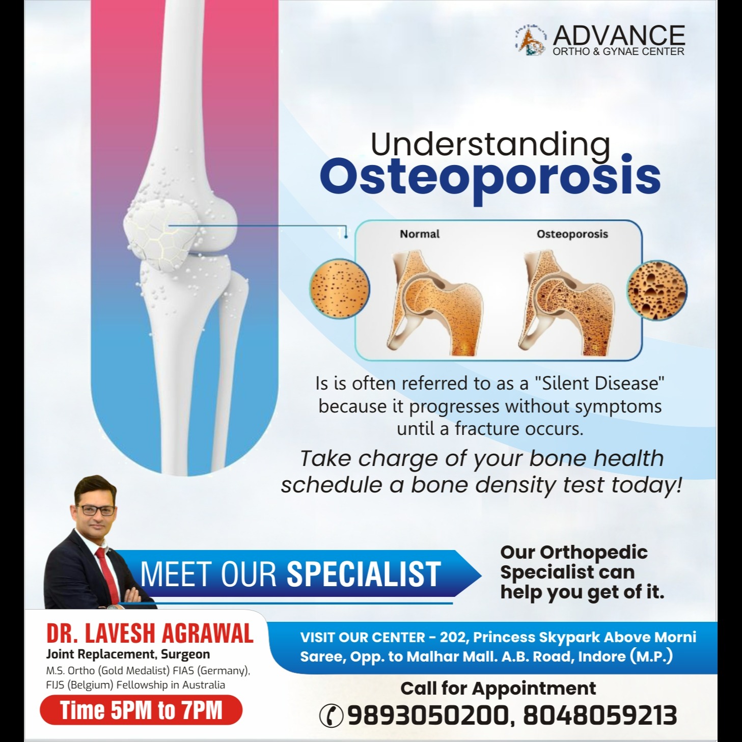Top Osteoporosis Specialist in Indore!
Dr. Lavesh Agrawal, at Advance Ortho & Gynae Center in Indore... main image