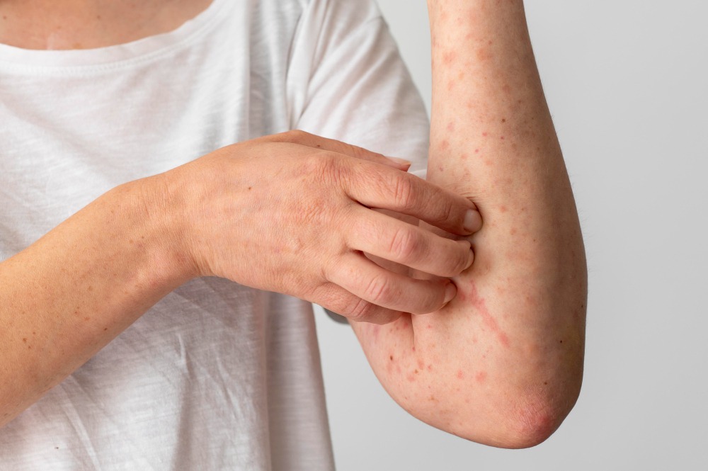 Skin Allergy Doctor in Chennai main image