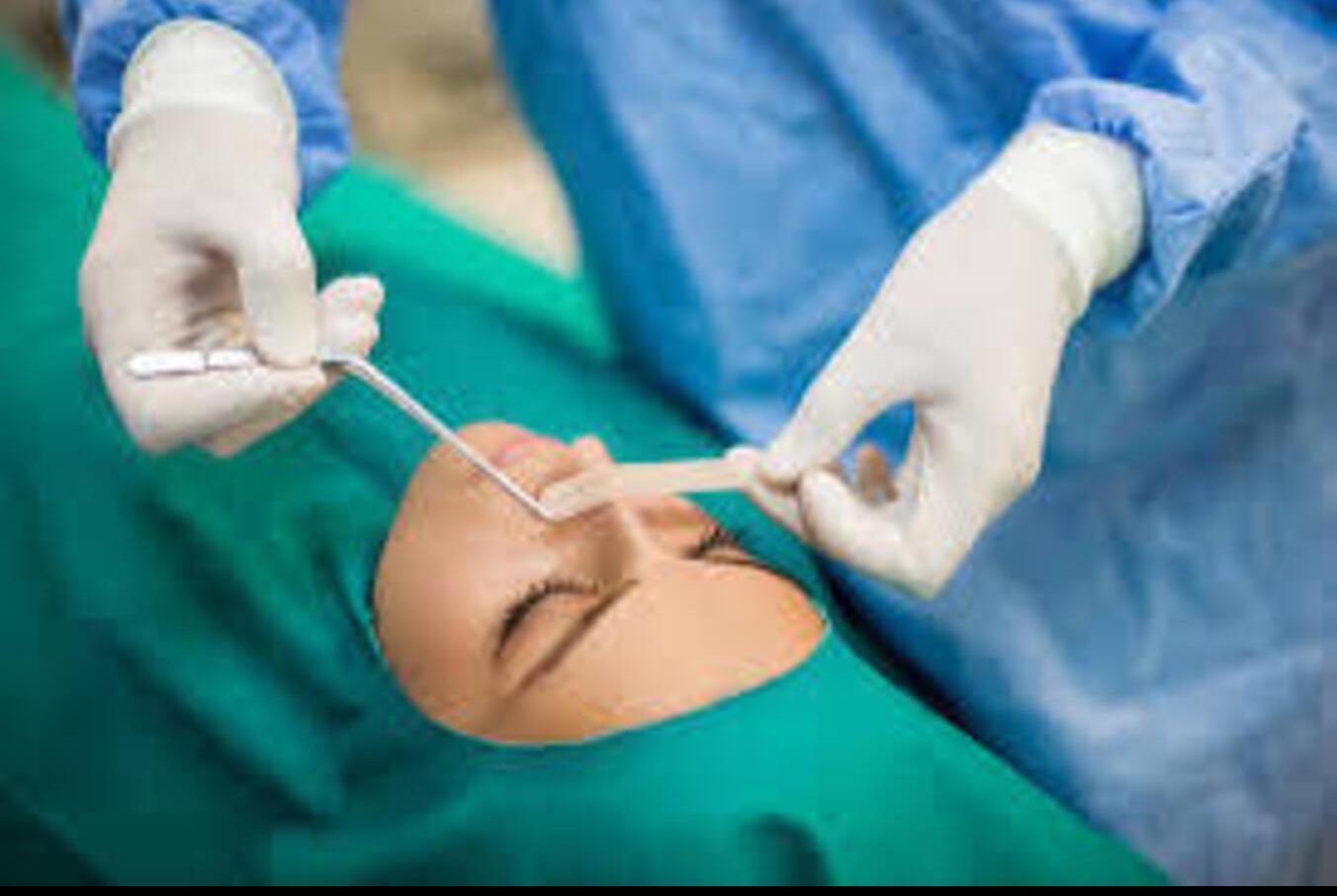 Septoplasty for DNS in Dwarka – Breathe Better, Sleep Dee... main image