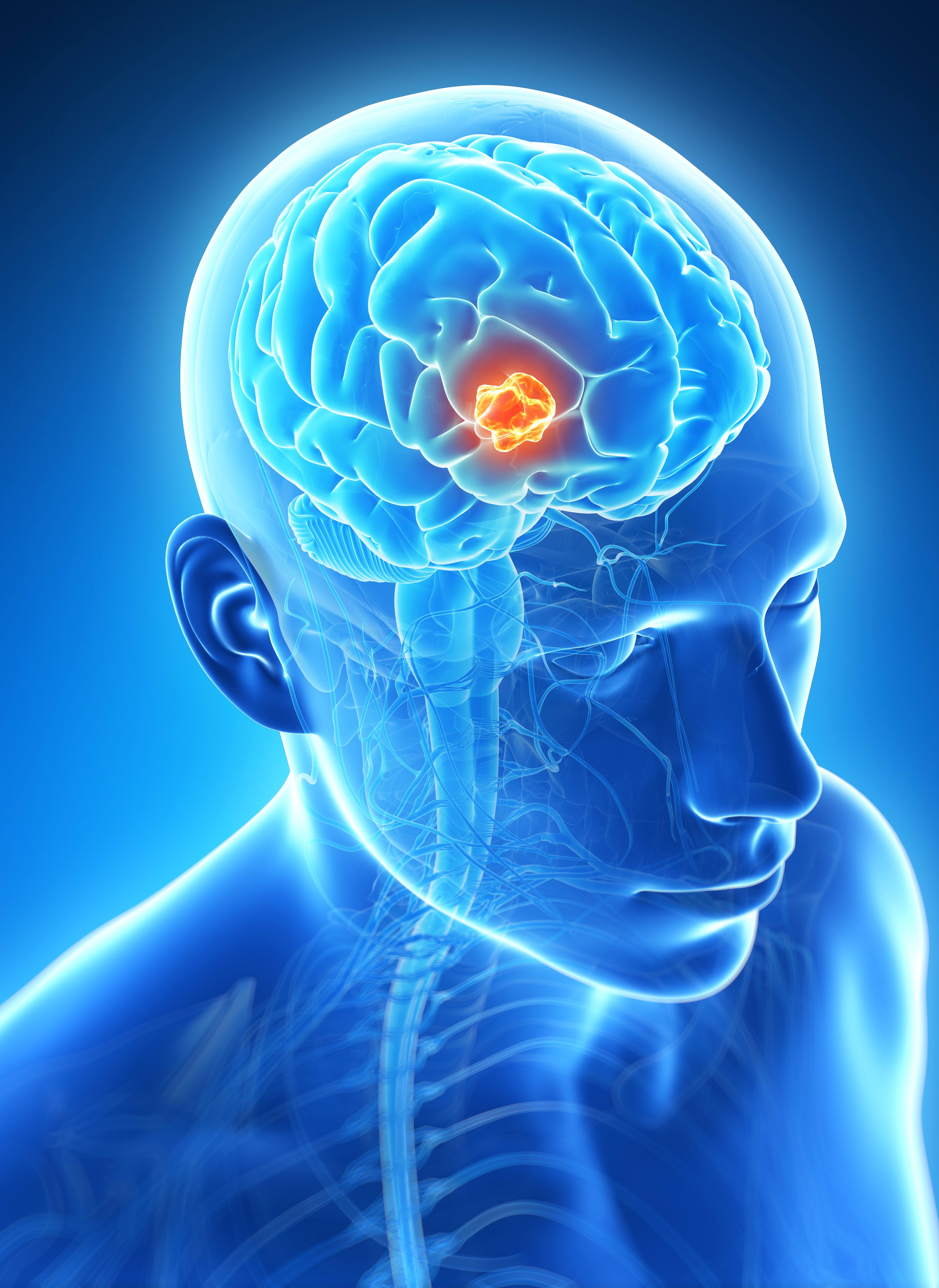 Surgeon for Brain Tumor in Jaipur Offering Precision C... main image