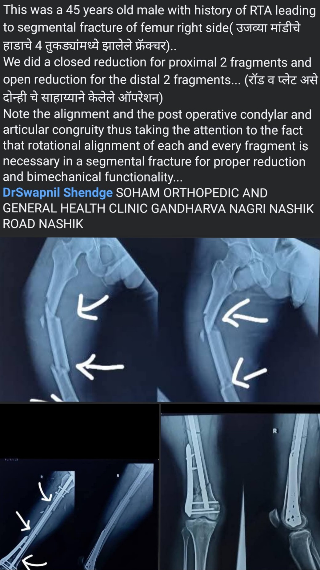 a recent case that we operated main image