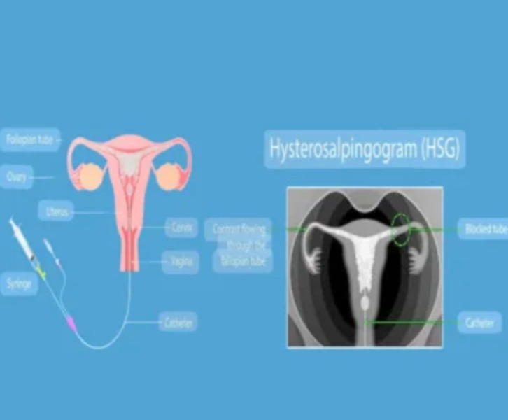 HSG and SSG Scans in Chennai – Clear Imaging for Fertility Evaluat... main image