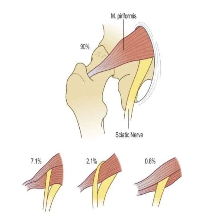 sciatica treatment at Sunshine clinic main image