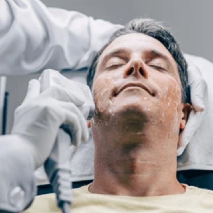 Non-Surgical Facelift with HIFU: The Safe, Scientific Way to Look Youn... main image