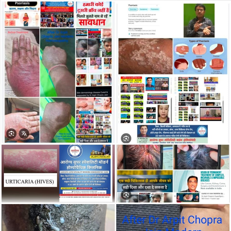 update image