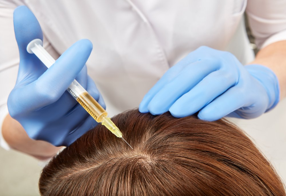 Dr. PRP for Hair Restoration What is Dr. PRP Thera main image