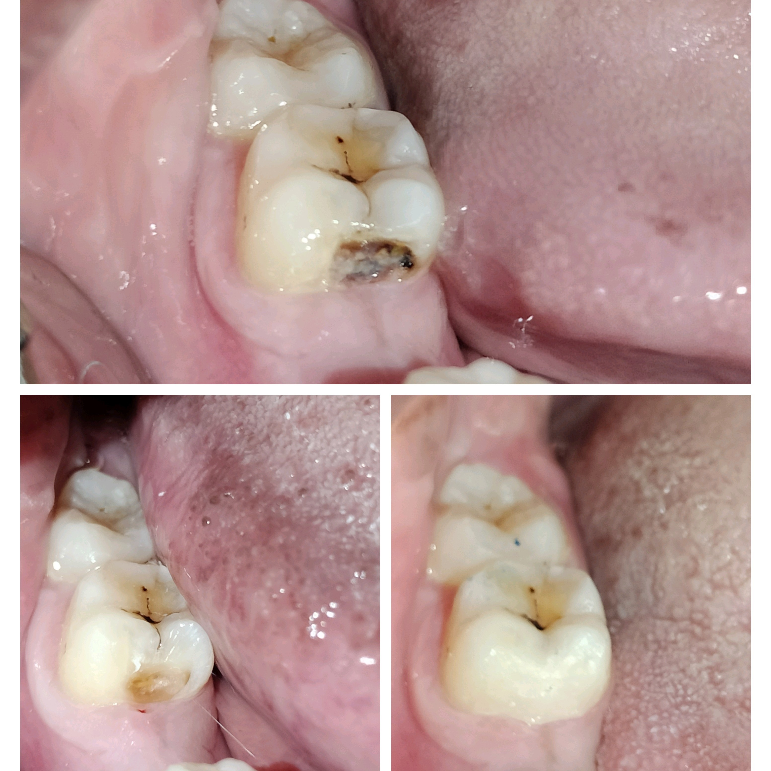 Best dental clinic in Mira Road main image