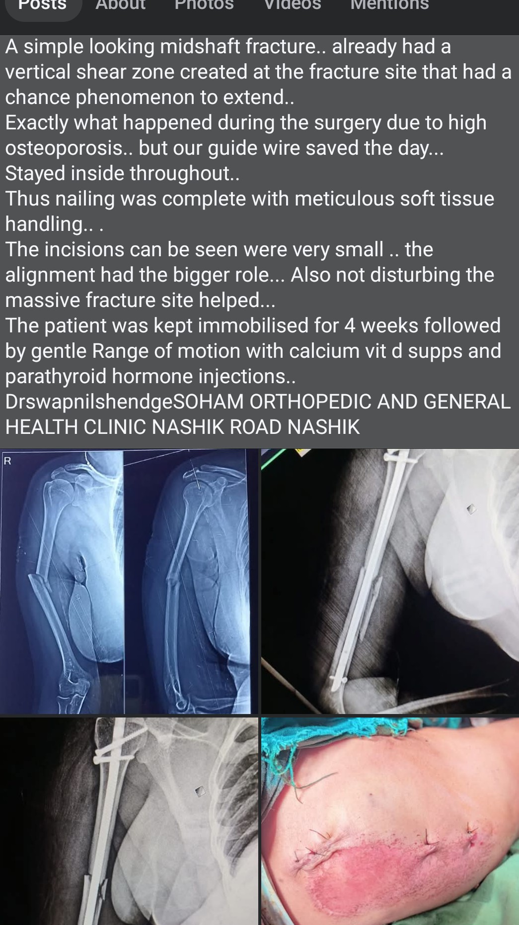 a recent difficult case that we operated ... main image