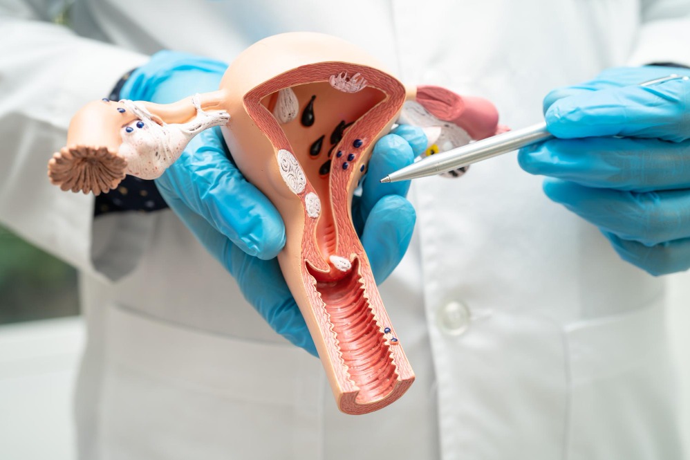 Safe Oophorectomy Surgery in Chennai at S A Hospi... main image