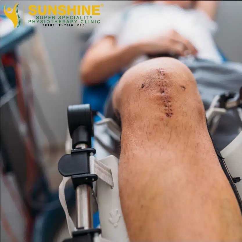 CPM for post operative knee surgery main image