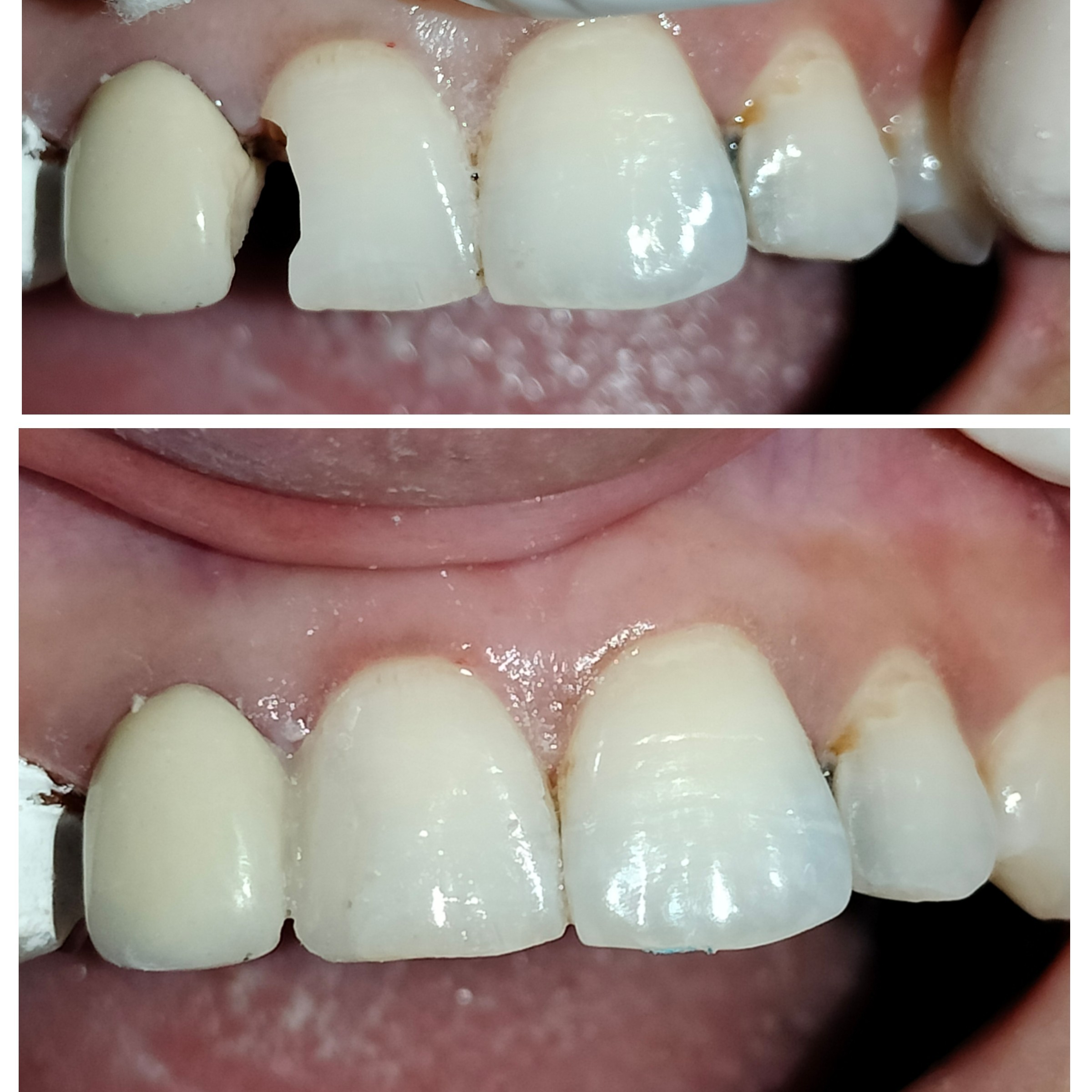 Best Dental Clinic near me main image