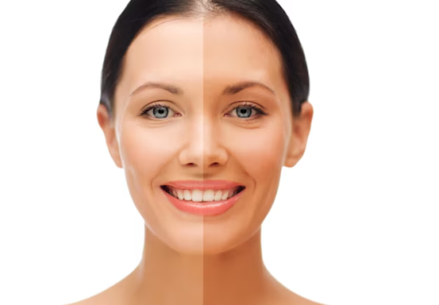 Skin Whitening in Dwarka – Gentle Brightening That Respects Your S... main image