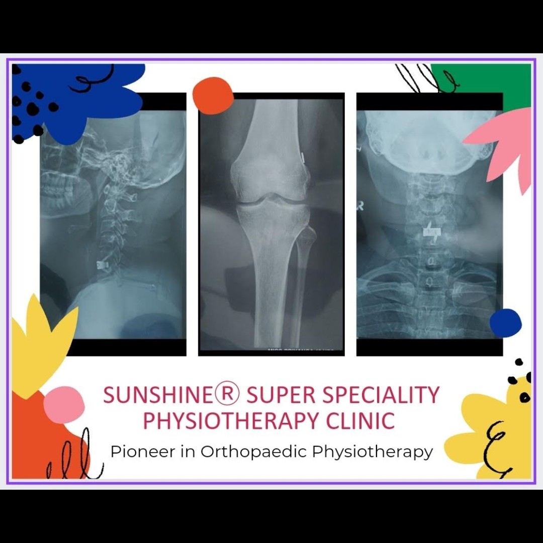 Physiotherapy treatment at home for Orthopedic Post Operative Cases main image