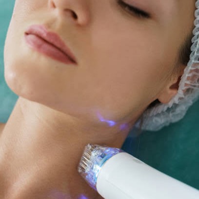 MNRF Treatment for Face: The Modern Solution for Clearer, Firmer Skin main image