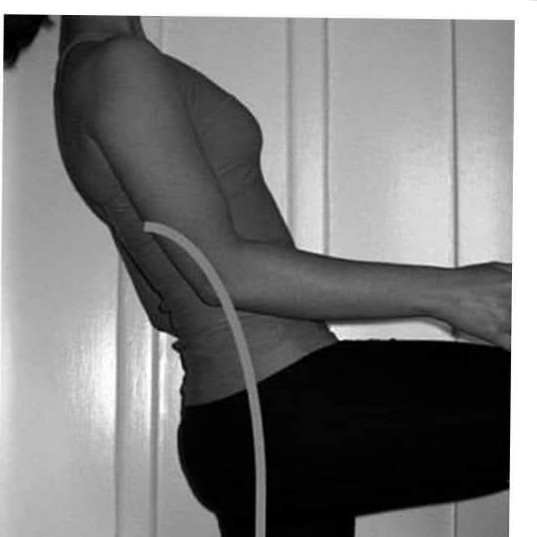 The Standing Stork Test is a clinical assessment for assessment of spondylolisthesis, main image