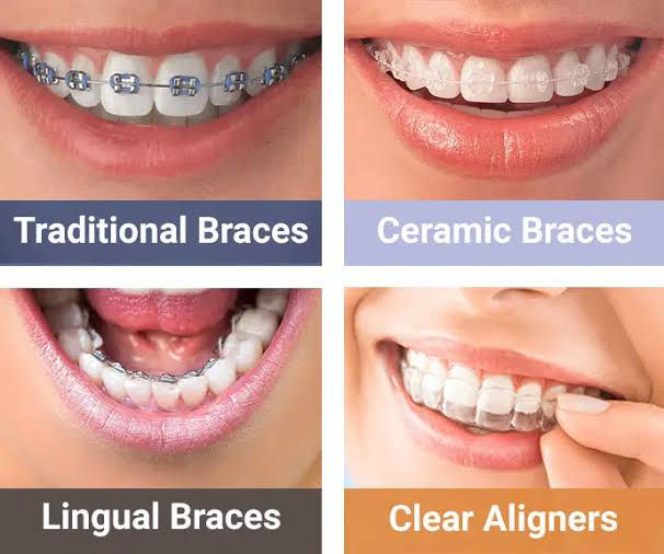 Braces Specialist in Jaipur main image