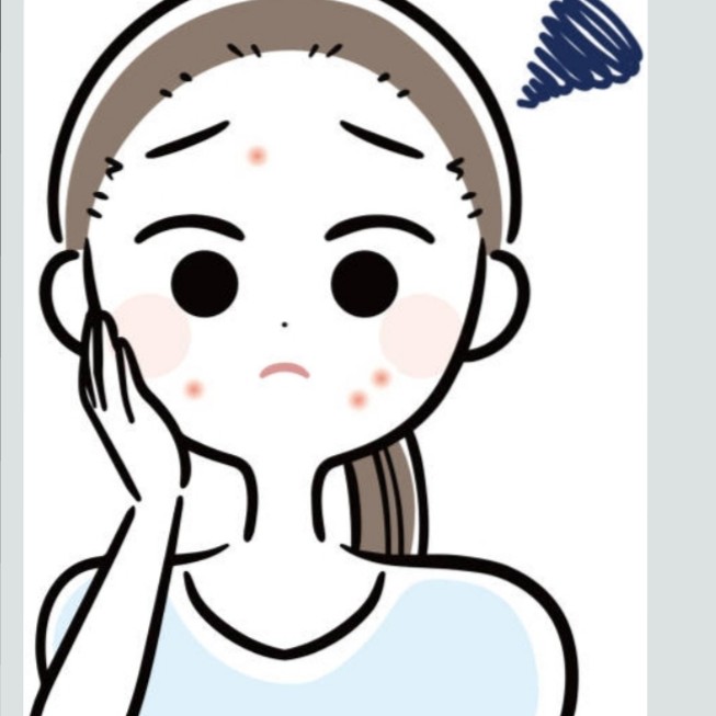 Microneedling for Face Hyperpigmentation main image