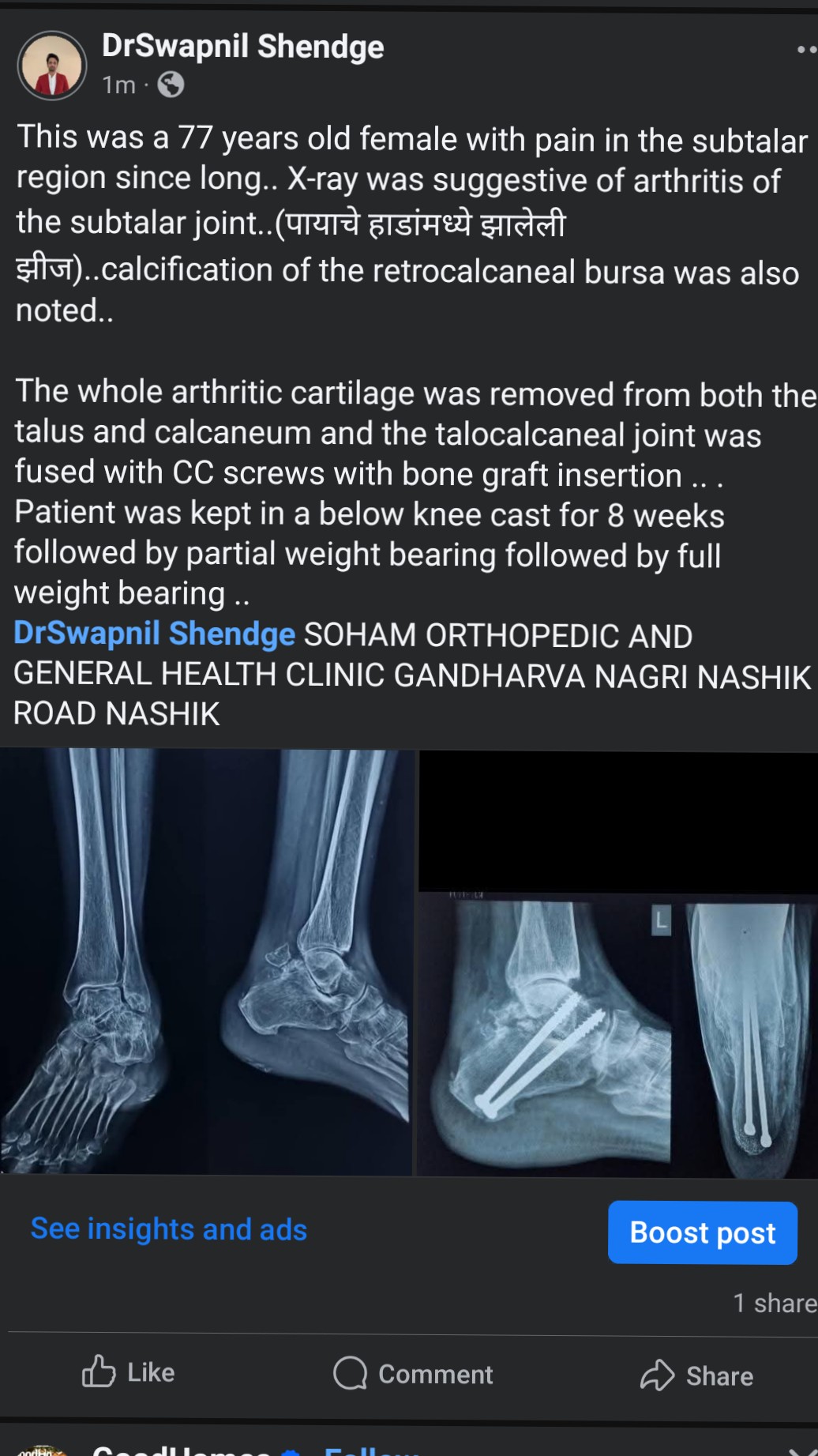 #arthritis treatment main image