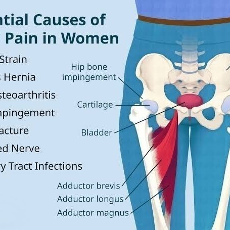 Groin Region Pain and Physiotherapy Treatment at Sunshine Super Speciality Physiotherapy Clinic, Tam main image