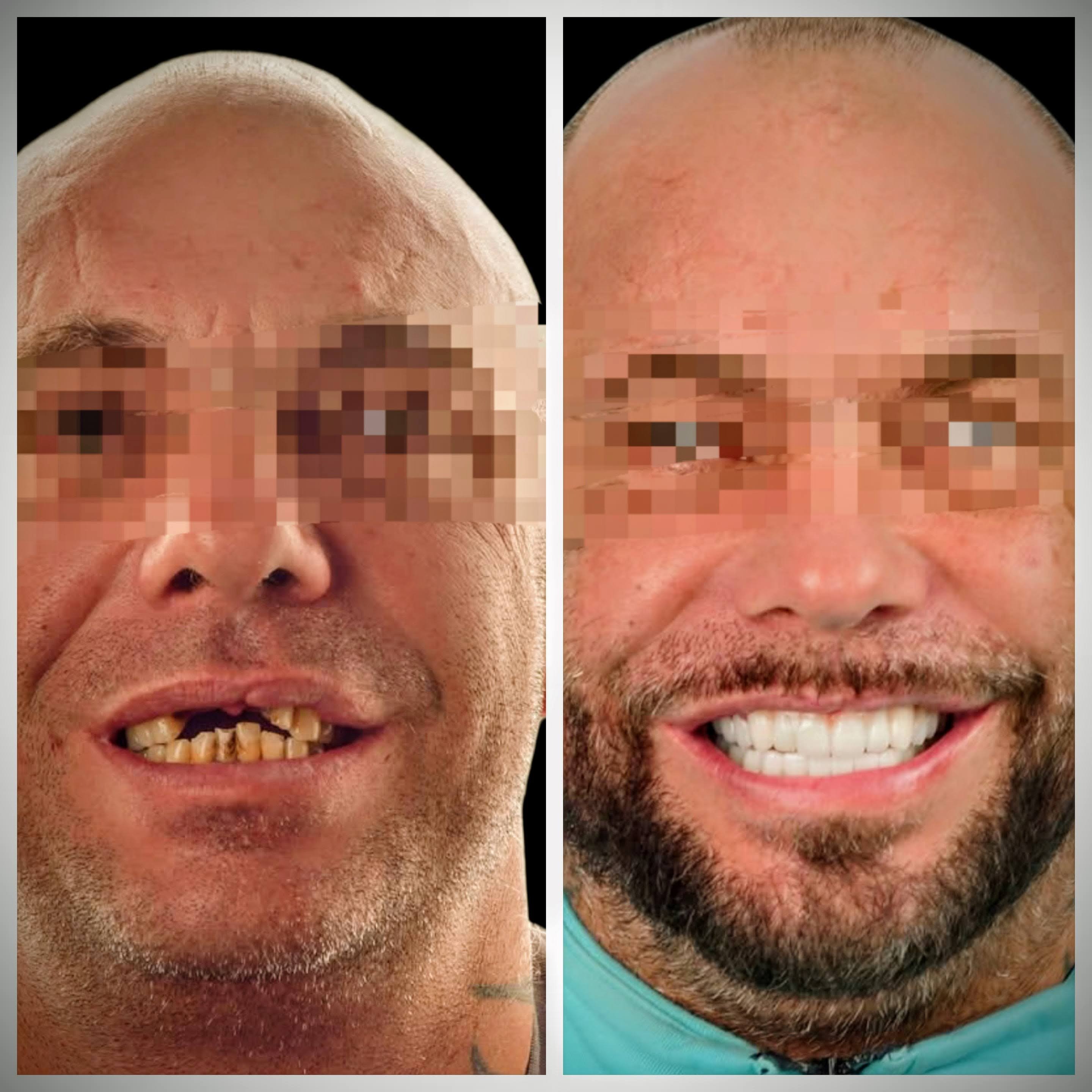 update image