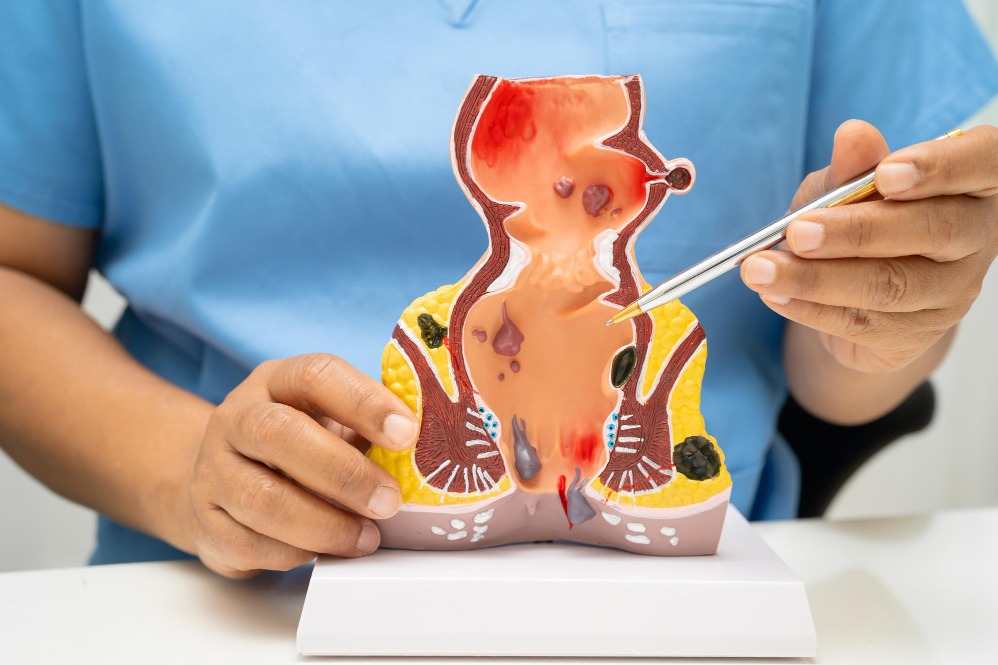 Proctologist In Tharamani – Get Professional Help For Anorectal Conditions main image