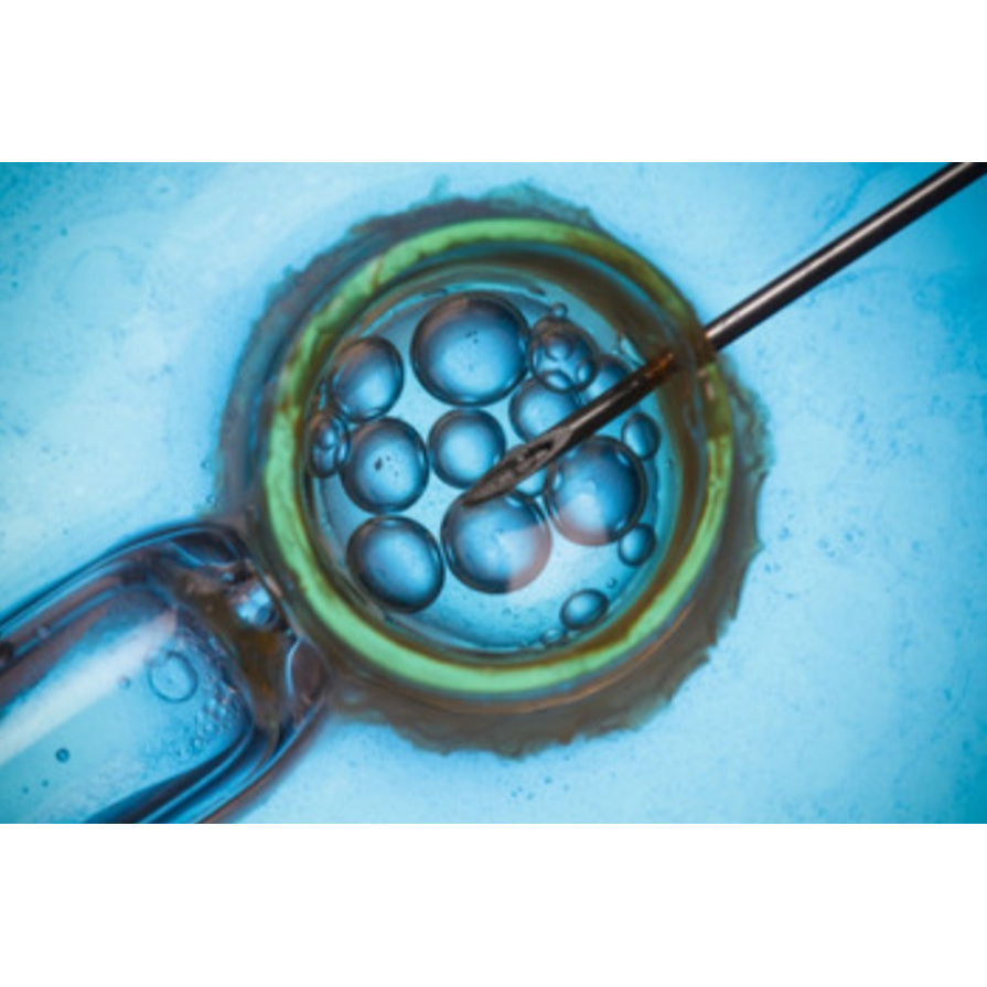 IVF in Coimbatore – Where Science Meets Compassion main image