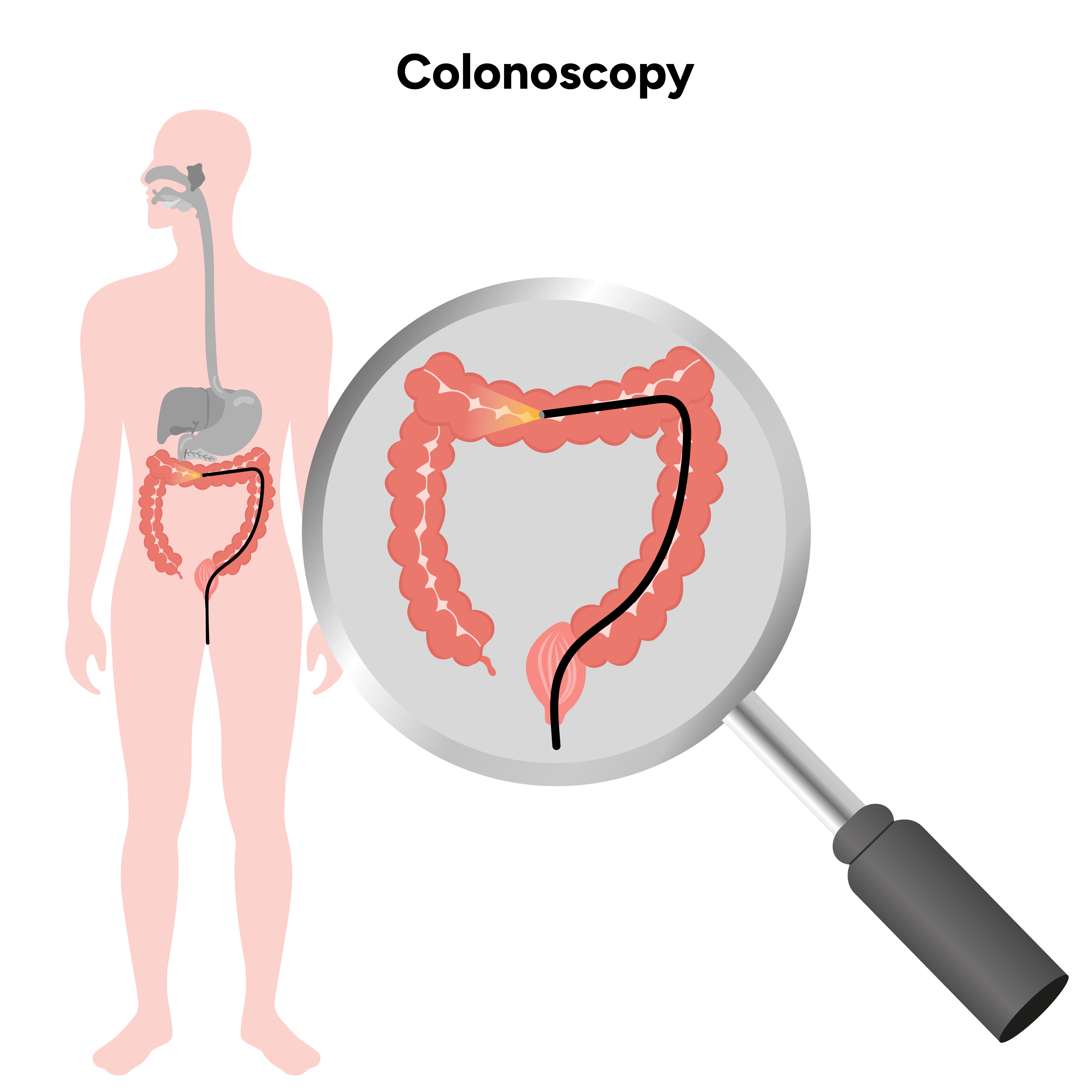 Endoscopy,Colonoscopy and ERCP + Stenting Services in Dombivli main image