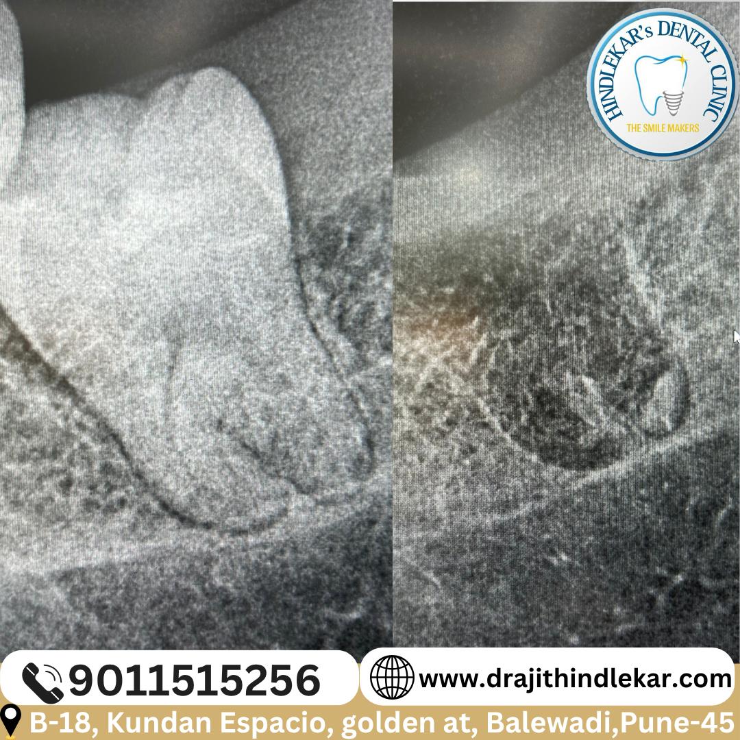 update image