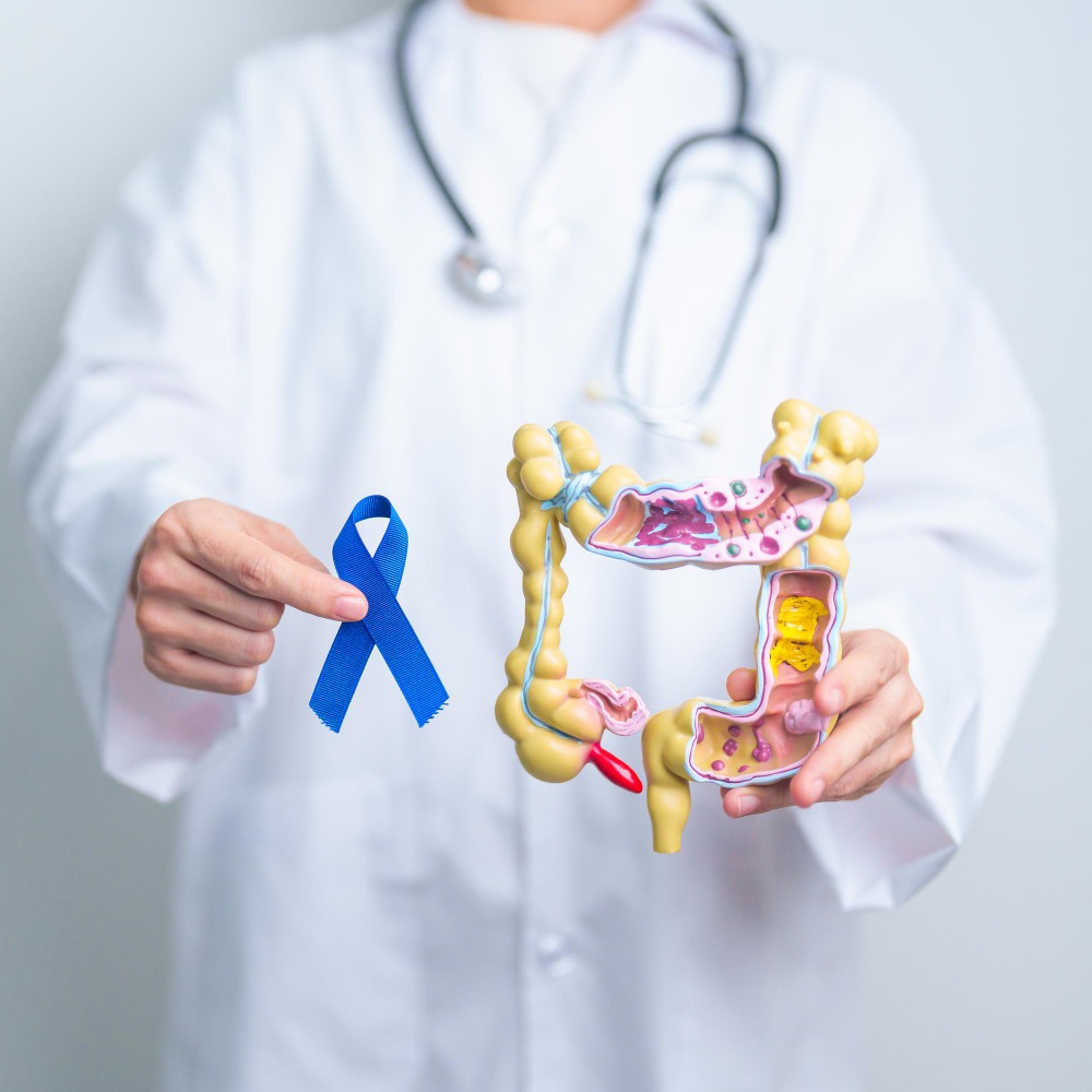 Get Safer, More Accurate Rectal Cancer Treatment Near Nelamangala with Robotic Surgery main image