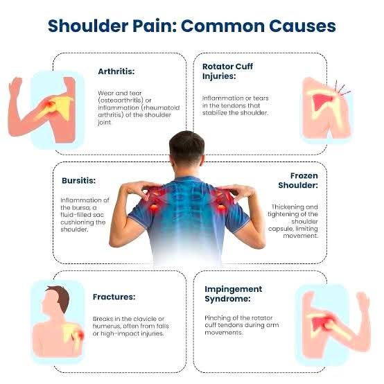 #Common_Causes of Shoulder Pain
》Rotator cuff injuries (tendinitis, tear) main image