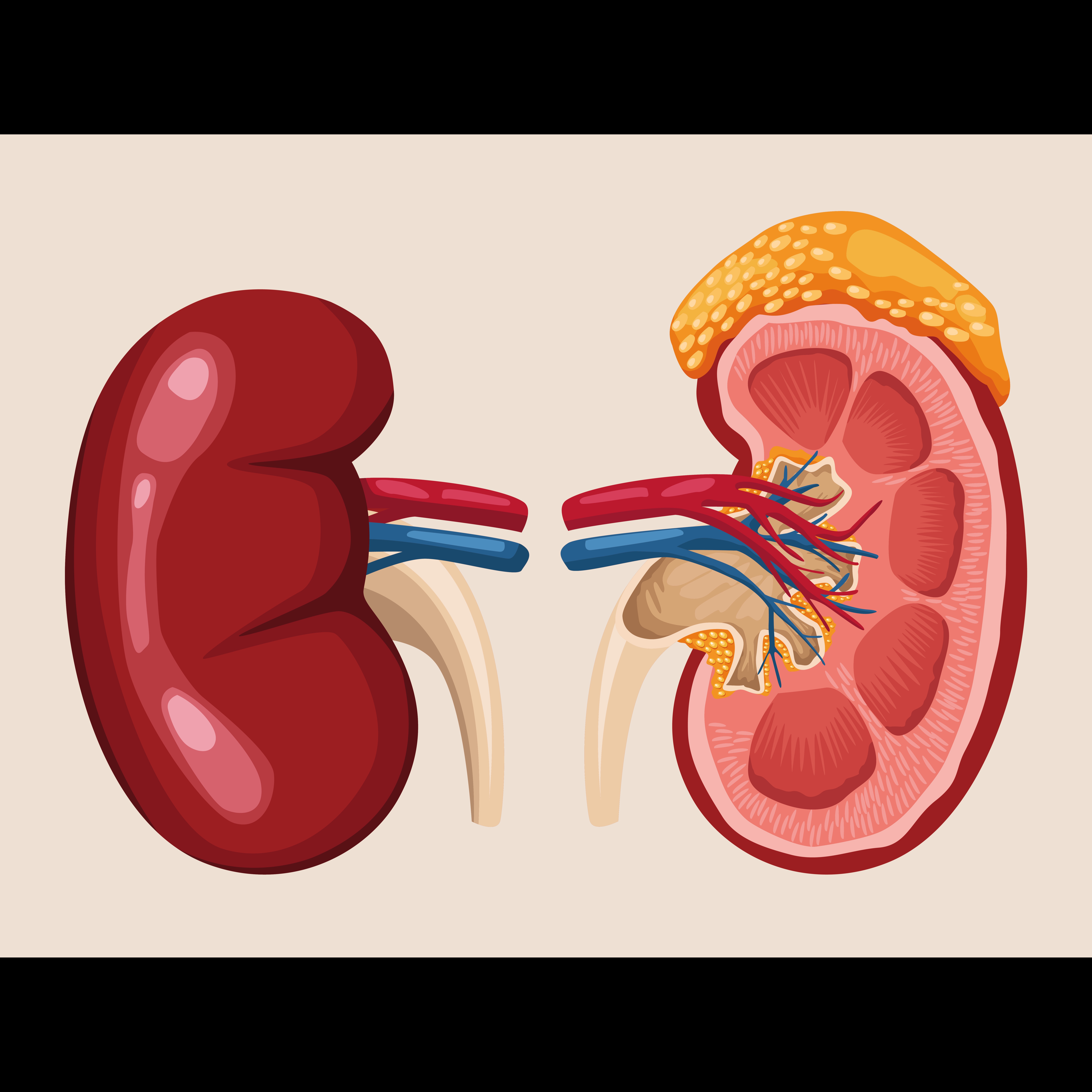 Laser Surgery Treatment for Kidney Stone in Dombivli – Painless Stone Removal  main image