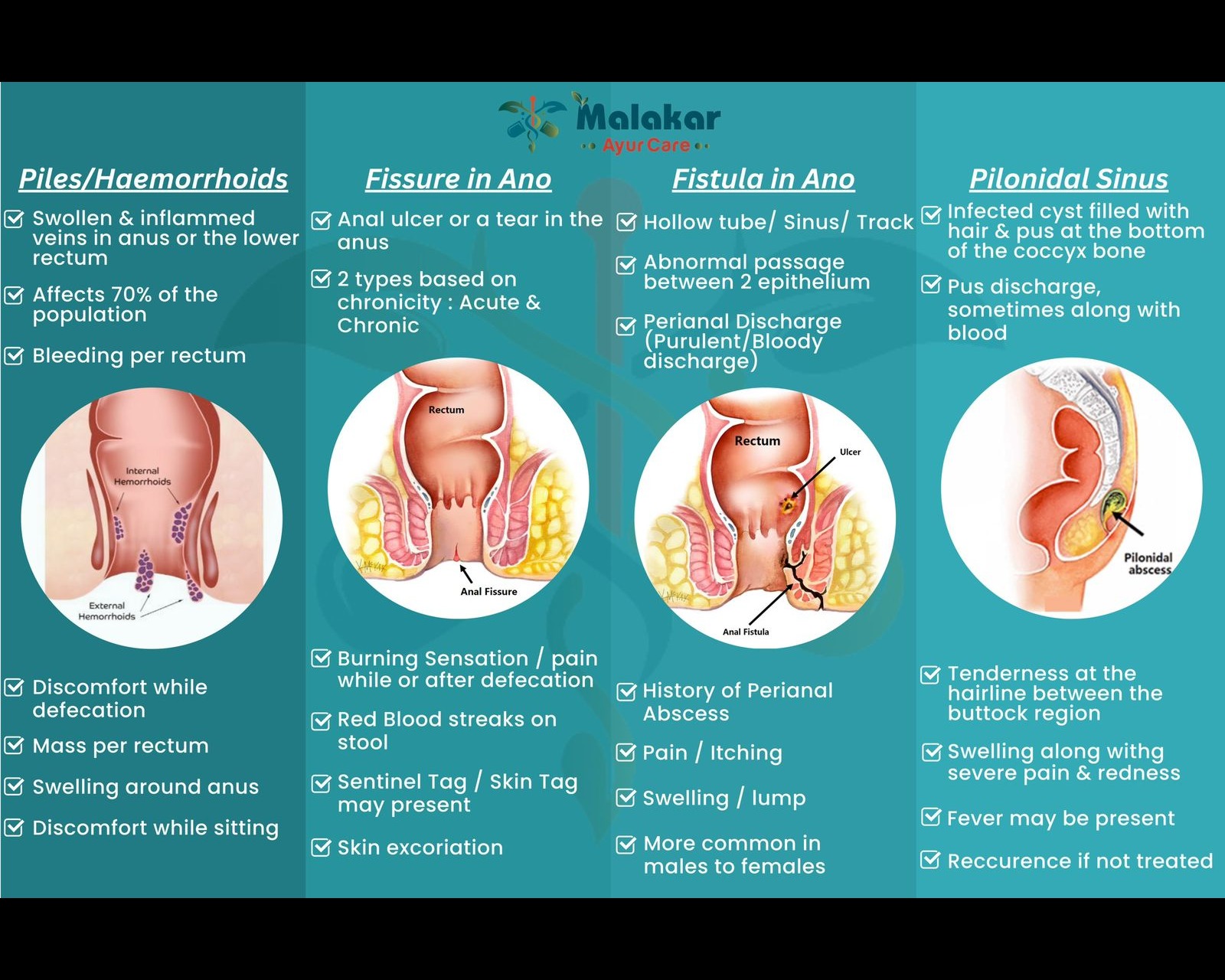 piles treatment in trichy Malakar Ayur Care main image