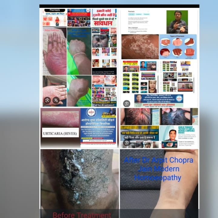 update image