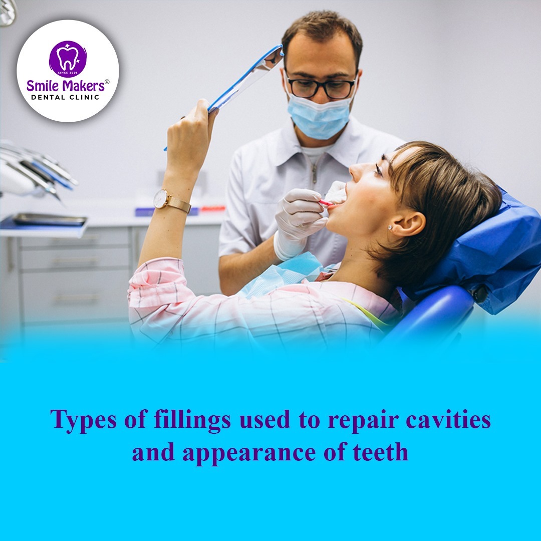 best filling dental clinic in pimple saudagar! Types of fillings used to repair cavities and appeara... main image