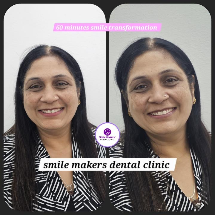 bestb smile designing clinic in pimple saudagar! Still hiding your smile due to gaps in your teeth?
... main image