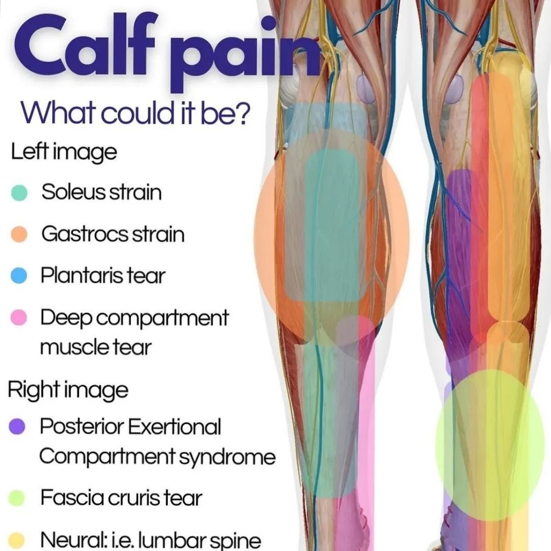 Calf pain πππ