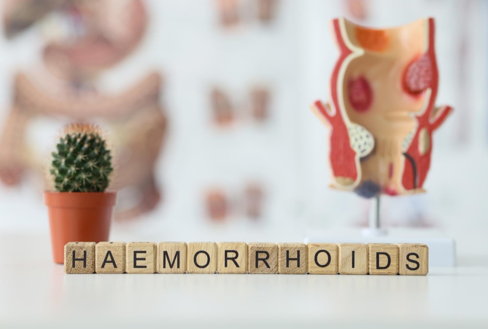 Haemorrhoids Treatment in Chennai – Lasting Relief at S A Hospital main image