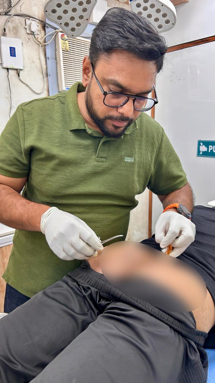 Pilonidal Sinus Treatment main image