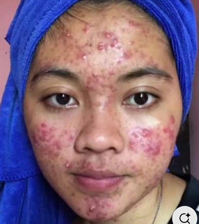 BEST SKIN ALLERGY DOCTOR IN SKIN main image