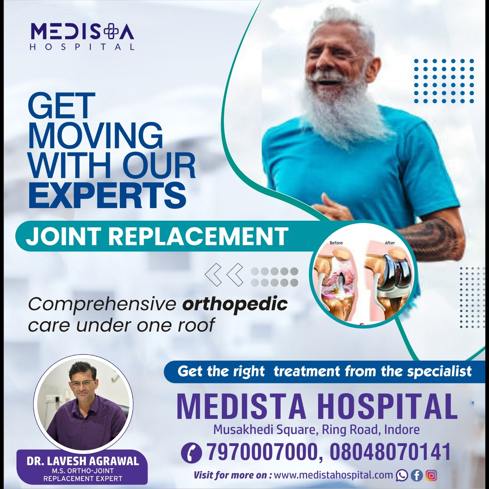Best Joint Replacement Surgery in Indore
Medista Hospital offers the best joint replacement surgery ... main image