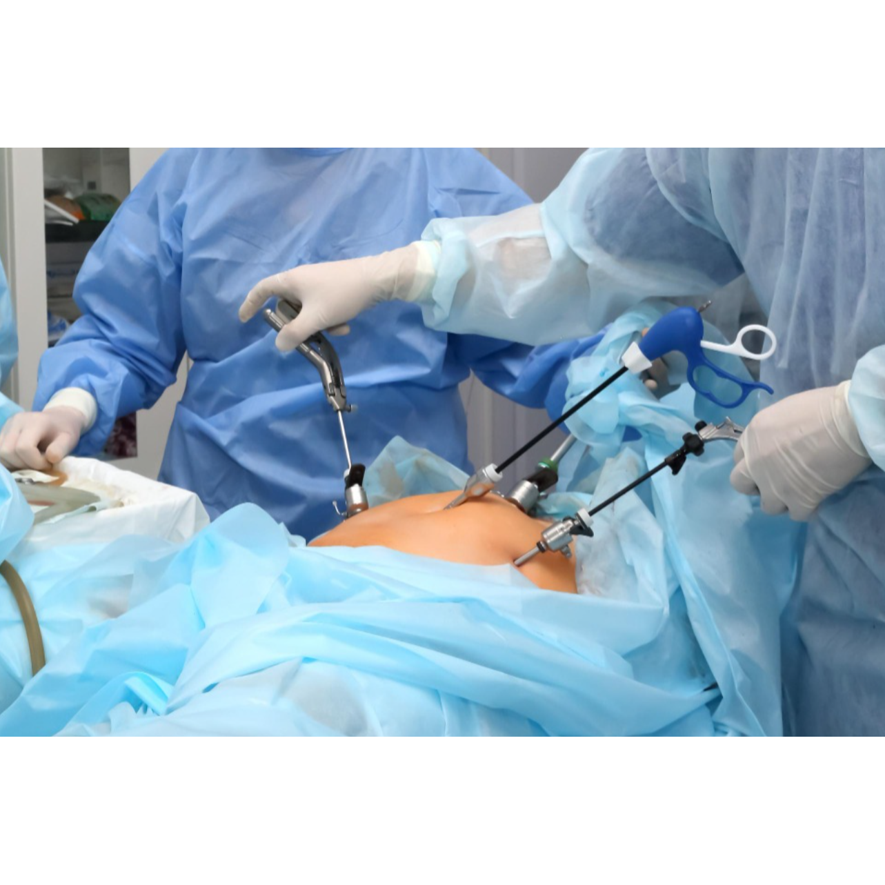 Laparoscopy Surgeon In Velachery – Safe, Scar-Minimizing Surgical Options main image