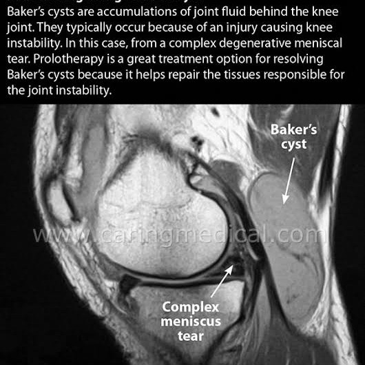Post Operative Physiotherapy treatment main image