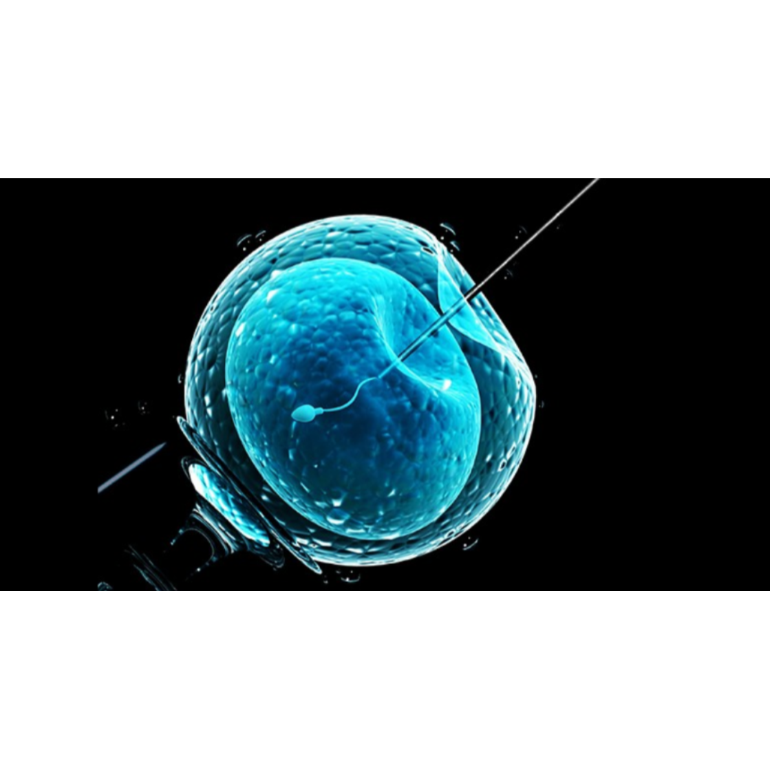 Fertility Specialist in Coimbatore – Guiding You Every Step main image