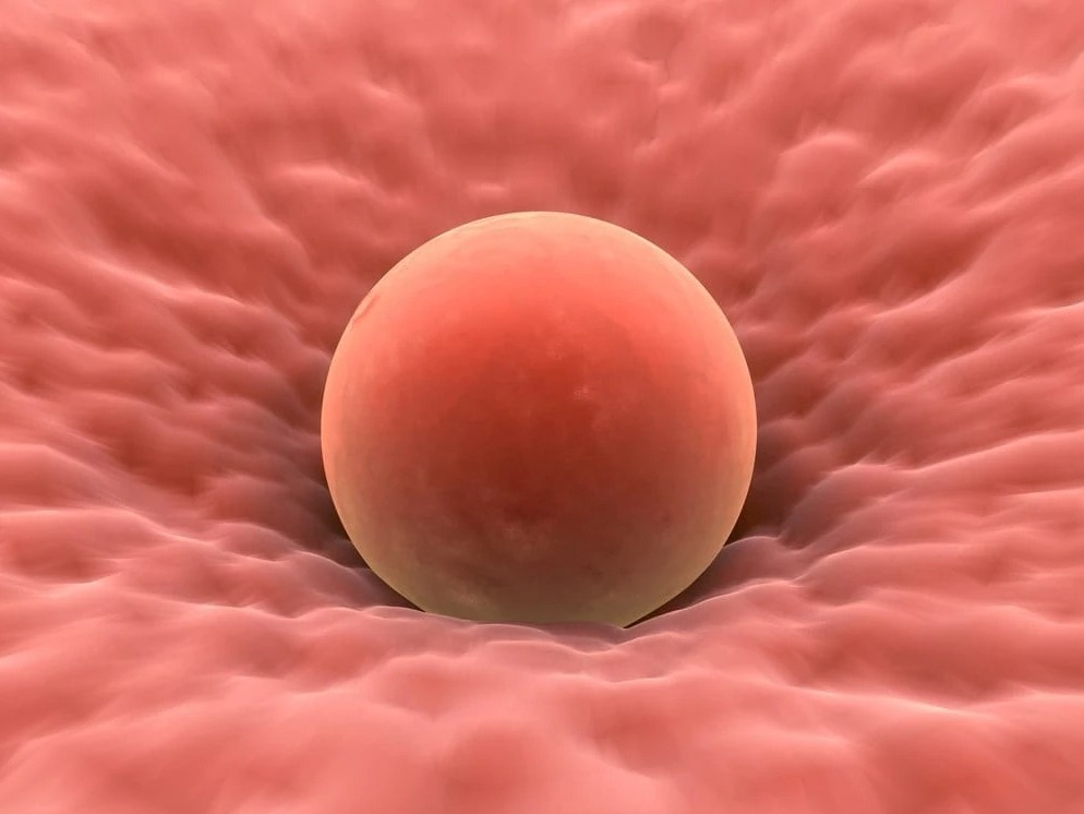 Why Donor Eggs IVF is more then a last resort  main image